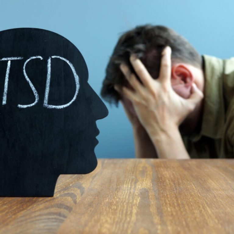 Head shape with PTSD Post traumatic stress disorder.