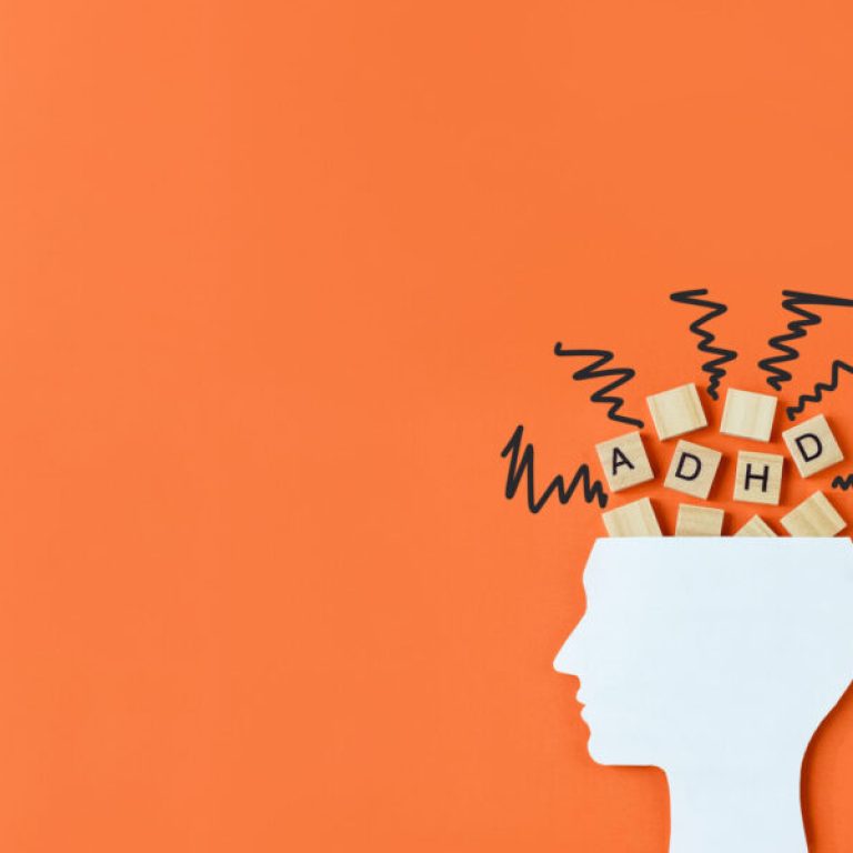 Silhouette of human head with chaotic lines and wooden blocks with the letters ADHD on orange background. Minimal concept of attention deficit hyperactivity syndrome. Copy space