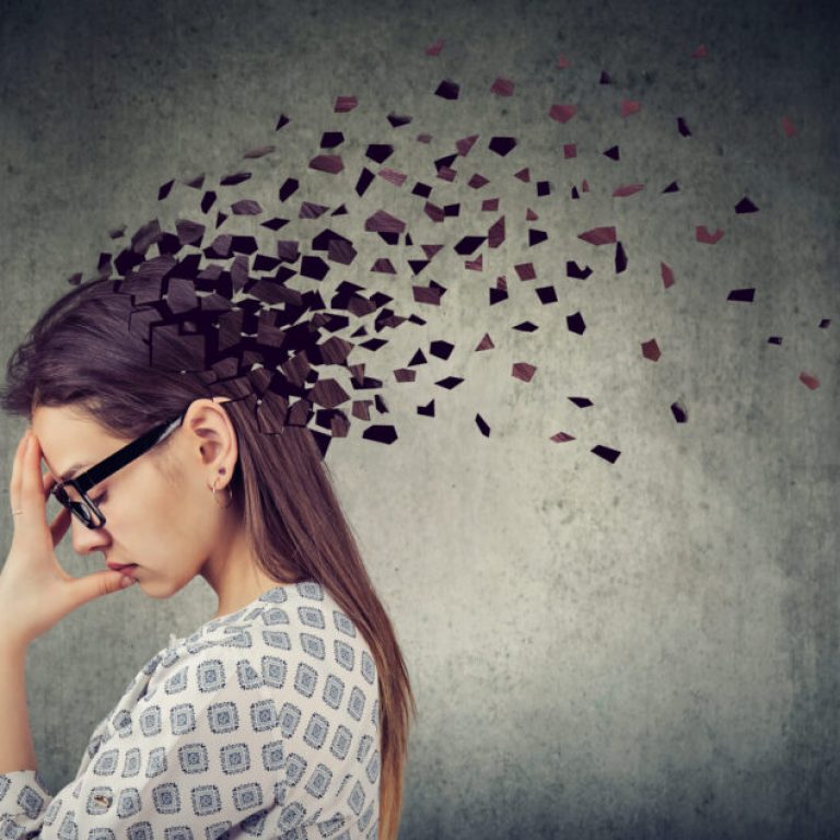Memory loss due to dementia or brain damage. Young woman losing parts of head as symbol of decreased mind function.